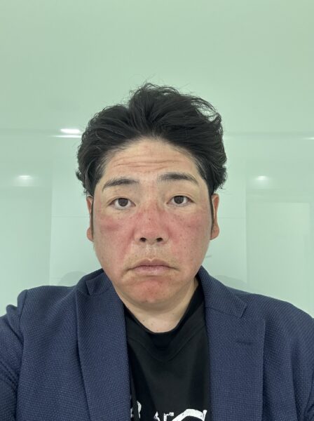 ドクターエバーズの経過報告